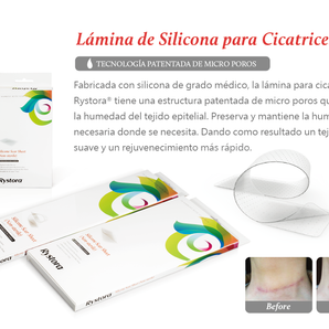 Rystora Lámina de Silicona para Cicatrices